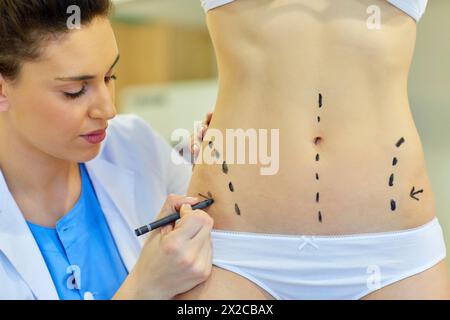 Abdomen. Tummy tuck. It is retensioning skin and abdominal muscles, by removing redundant skin and musculature plication. Before surgery should be tak Stock Photo