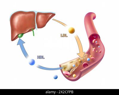 High density and low density lipoproteins adding and removing ...
