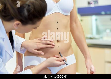 Abdomen. Tummy tuck. It is retensioning skin and abdominal muscles, by removing redundant skin and musculature plication. Before surgery should be tak Stock Photo