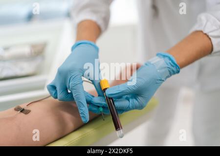 Unrecognizable female lab assistant in blue medical gloves taking venous blood from arm of woman patient for examination or PRP procedure. Concept of Stock Photo