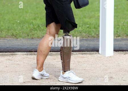 01.09.2023, Iffezheim, Baden-Wuerttemberg, Germany - Germany - Close-up: Woman wearing a lower leg prosthesis. 00S230901D874CAROEX.JPG [MODEL RELEASE: Stock Photo
