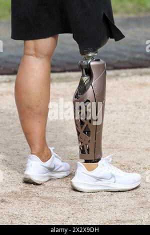 01.09.2023, Iffezheim, Baden-Wuerttemberg, Germany - Germany - Close-up: Woman wearing a lower leg prosthesis. 00S230901D875CAROEX.JPG [MODEL RELEASE: Stock Photo