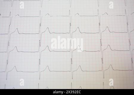 Electrocardiogram in pink paper form in hospital, close up view Stock Photo