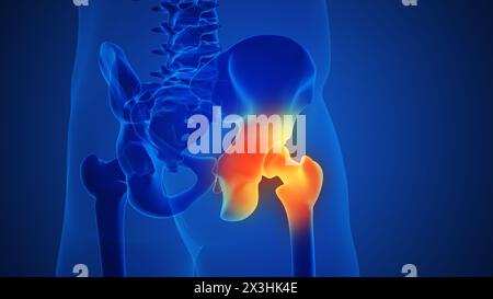Painful hip joint with blue background Stock Photo