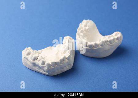 Dental model with gums on blue background. Cast of teeth Stock Photo