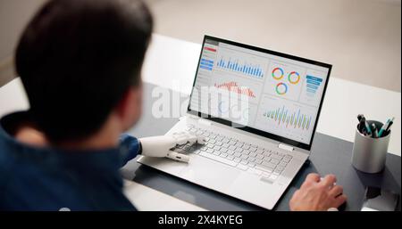 Man With Prosthetic Hand Working On Laptop. Artificial Limb Stock Photo