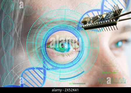 Installing electronic chip into human bionic, neuroprosthetic eye ...