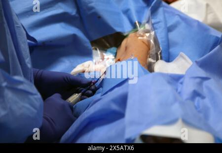 Patient having Peripherally Inserted Central Catheter (Picc Line) Administered under Local Anaesthetic in Hospital Surrey England Stock Photo