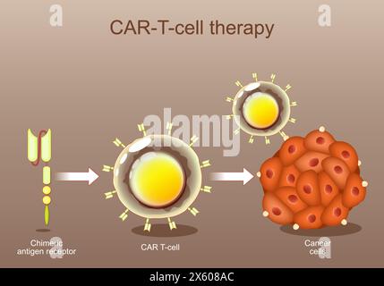 CAR-T cell therapy. cancer immunotherapy. Chimeric antigen receptor. Genetic engineering. Personalized medicine. Tumor targeting. Vector illustration. Stock Vector