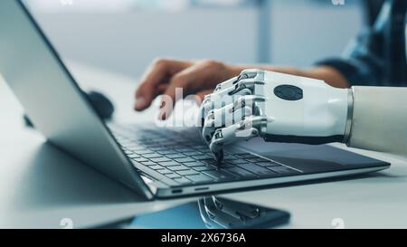 Close-up on Hands: Person with Disability Using Prosthetic Arm to Work on Laptop Computer. Specialist Swift and Natural Use of Thought Controlled Body Powered Myoelectric Bionic Hand. Stock Photo