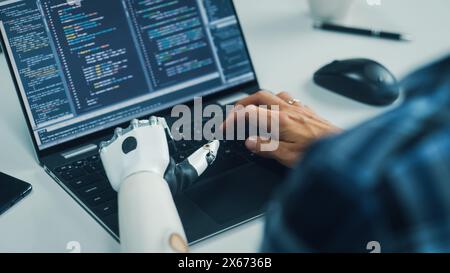 Over Shoulder Hands Close-up: Programmer With Disability Using Prosthetic Arm to Work on Laptop Computer. Specialist Swift and Natural Use of Myoelectric Bionic Hand To Type Code for Software Stock Photo