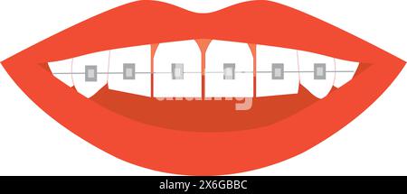 Smile with white teeth and orthodontic braces. Stock Vector