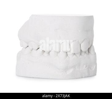Dental model with gums isolated on white. Cast of teeth Stock Photo