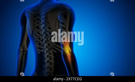 Female having pain in elbow Stock Photo