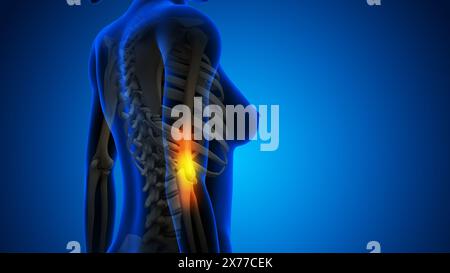 Female having pain in elbow Stock Photo