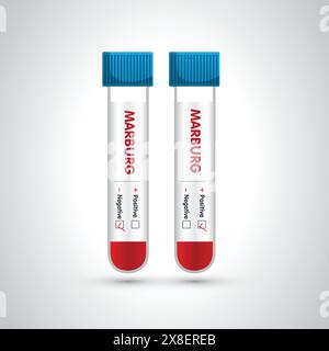 Blood sample tube positive for Marburg virus, Blood in the test tube icon. vector illustration. the blood vial and test kit. It can be used in medical Stock Vector