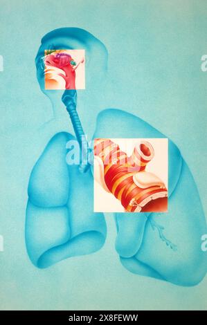Respiratory track with cross-section of a bronchus. BRONCHUS, DRAWING 001366 007 Stock Photo