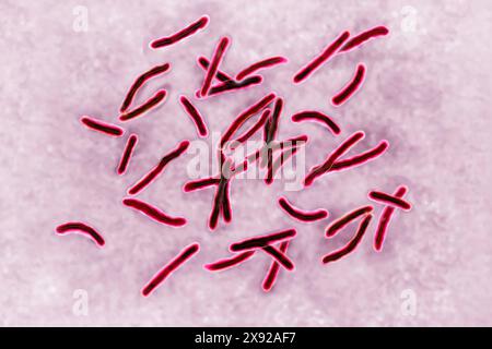 Bacillus Koch Bk or Mycobacterium tuberculosis, it is responsible for tuberculosis. Tuberculosis is making a comeback due to the appearance of multi-resistant bacterial strains. Pulmonary tuberculosis phthisis is the most widespread, but there are bone disorders Pott s disease, white tumor of the knee, renal, intestinal, genital, meningeal and skin disorders tuberculomas. Image taken from an X 1000 optical microscopy. Koch s bacillus 016813 004 Stock Photo