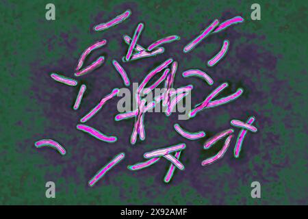 Bacillus Koch Bk or Mycobacterium tuberculosis, it is responsible for tuberculosis. Tuberculosis is making a comeback due to the appearance of multi-resistant bacterial strains. Pulmonary tuberculosis phthisis is the most widespread, but there are bone disorders Pott s disease, white tumor of the knee, renal, intestinal, genital, meningeal and skin disorders tuberculomas. Image taken from an X 1000 optical microscopy. Koch s bacillus 016813 007 Stock Photo