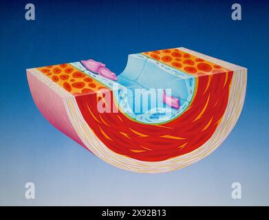 Cross-section of a blood vessel, with platelets in purple BLOOD VESSEL, DRAWING 001248 007 Stock Photo