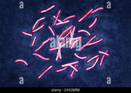 Bacillus Koch Bk or Mycobacterium tuberculosis, it is responsible for tuberculosis. Tuberculosis is making a comeback due to the appearance of multi-resistant bacterial strains. Pulmonary tuberculosis phthisis is the most widespread, but there are bone disorders Pott s disease, white tumor of the knee, renal, intestinal, genital, meningeal and skin disorders tuberculomas. Image taken from an X 1000 optical microscopy. Koch s bacillus 016813 005 Stock Photo