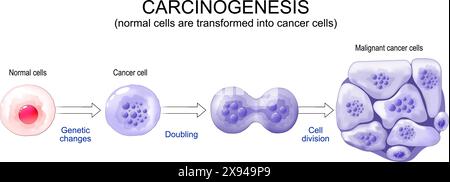Cancer development. Normal cells are transformed into cancer. Carcinogenesis from Genetic mutations in healthy cell to Malignant cancer cells. Mutagen Stock Vector