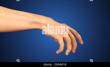 Medical Concept of eczema on hand skin Stock Photo