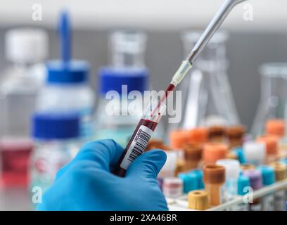 Laboratory technician pipetting blood sample for analysis. Stock Photo
