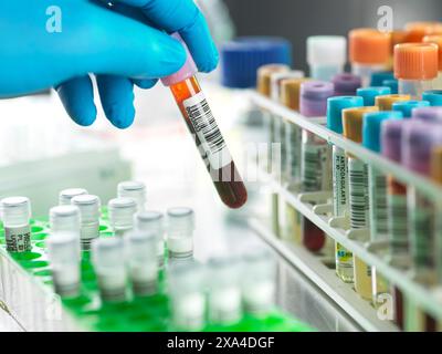 Medical Screening, Scientist preparing a blood sample for automated analysis in the lab Stock Photo