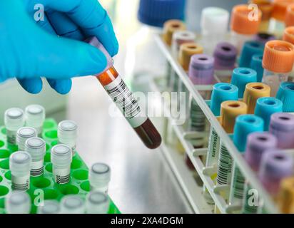 Medical Screening, Scientist preparing a blood sample for automated analysis in the lab Stock Photo