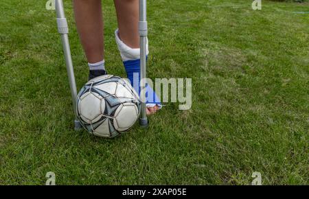 Boy with a broken leg in a cast during a football match an injury to a young athlete Stock Photo