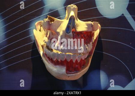 Medical props showing anatomy of the mouth, gums, and nose on a human face. Stock Photo