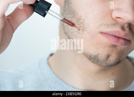 young man applying beard growth oil with pipette close up. man holding pipette with oil for beard, applying cosmetic serum with pipette onto face Stock Photo