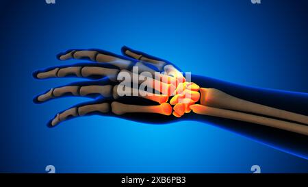 Pain in the wrist joint Stock Photo