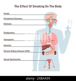 Effects of cigarette smoking on human body. Health issues and risks of smokers. Human internal organs diseases caused by nicotine. Flat vector illustration Stock Vector