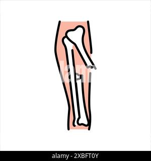 Bone fractures line color icon. Household injuries sign for web page, mobile app, button, logo. Vector isolated button. Editable stroke. Stock Vector