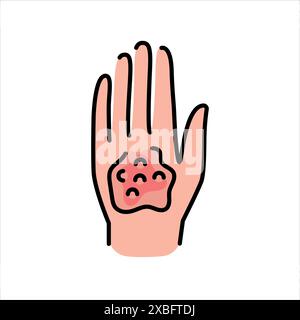 Burns line color icon. Household injuries sign for web page, mobile app, button, logo. Vector isolated button. Editable stroke. Stock Vector