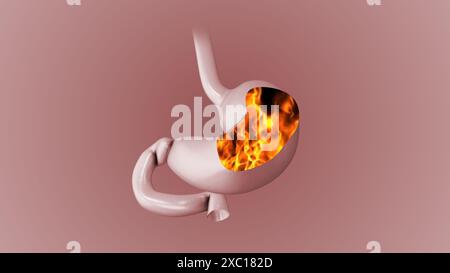 Stomach ache and a burning sensation Stock Photo