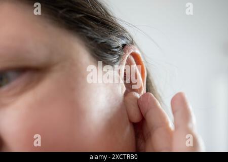 caucasian mature woman holding painful ear close up, hearing loss, Ear Discomfort, Health, Acute Otitis Media, Treatment and Care, Diagnosing and Trea Stock Photo