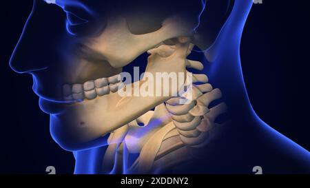 Broken Jaw joint with Metal Plate and Screws Stock Photo