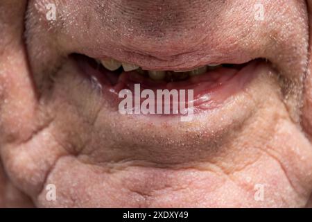 A close up of an elderly mans mouth, on a sunny day Stock Photo