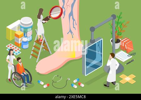 3D Isometric Flat  Conceptual Illustration of Varicose Veins, Enlarged and Twisted Vein Treatment 3D Isometric Flat  Conceptual Stock Photo