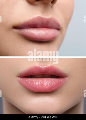 Permanent makeup. Collage with photos of woman before and after lip blushing, closeup Stock Photo