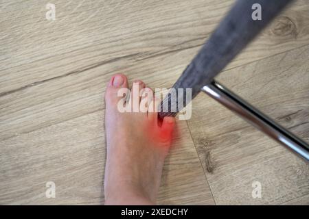 Woman hit chair with the little toe. Incident at home. Red spot showing injury of foot little finger Stock Photo