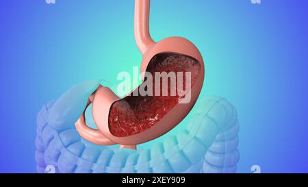 Upper gastrointestinal endoscopy medical animation Stock Photo