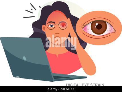 Digital Eye Strain, Person sitting on worktable with eye strain - Stock Illustration as EPS 10 file Stock Vector