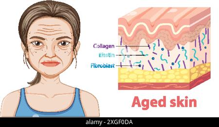 Illustration showing layers and components of aged skin Stock Vector ...