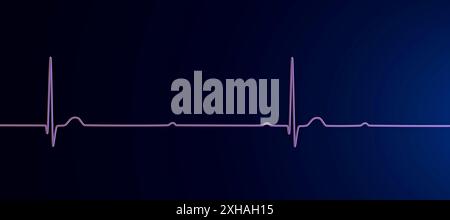 Illustration of an electrocardiogram (ECG) depicting a complete heart ...