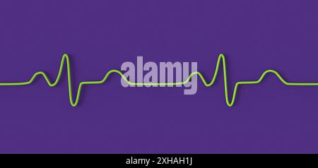 Illustration of an electrocardiogram (ECG) depicting a bundle branch block. This occurs when something blocks or disrupts the electrical signal that causes the heart to beat. The ECG shows widened QRS complexes and altered ventricular depolarisation. Stock Photo