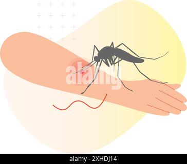 Mosquito biting on Human Skin - Stock Illustration as EPS 10 File Stock Vector